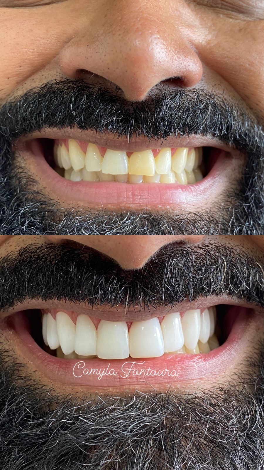 Antes e depois de reabilitação oral
